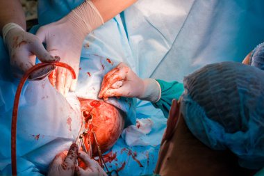 Cerrahlar ameliyat sırasında insan derisini dikmek için tıbbi aletler kullanırlar.