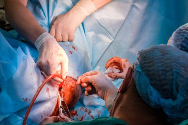 Moskova. - Rusya. 11 Mart 2021. Cerrahlar ameliyat sırasında insan derisini dikmek için tıbbi aletler kullanırlar.