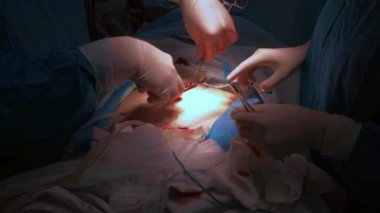 Doktorlar insan derisini dikmek için tıbbi aletler ve metal iplik kullanıyorlar..