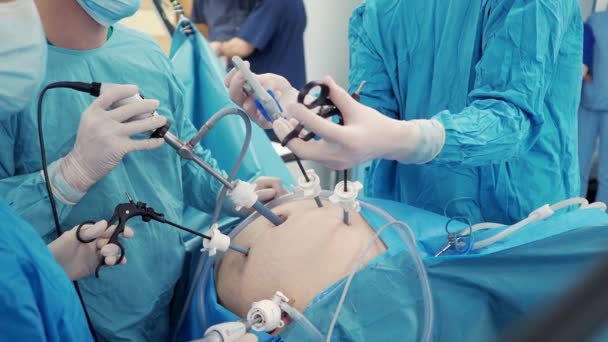 Хирург держит в руках специальные медицинские инструменты во время операции. — стоковое видео