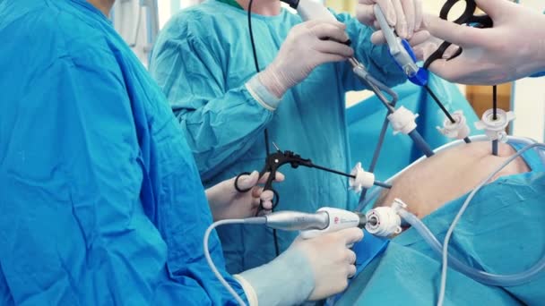 The surgeon holds special medical instruments in his hands during the operation. — Stock Video