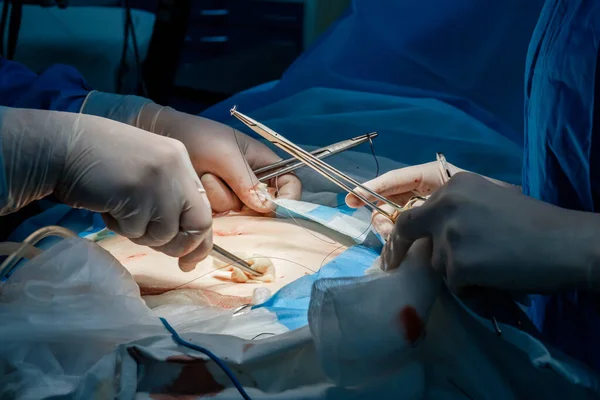 Doctors use medical instruments and metal thread to suture human skin.