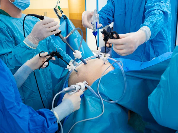 Cirujanos realizan cirugía laparoscópica usando instrumentos médicos especiales. — Foto de Stock