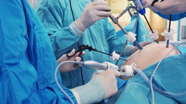 The surgeon holds special medical instruments in his hands during the operation. — Stock Video