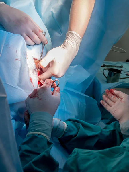 A surgical instrument in the bloodied hands of surgeons during a surgical operation.