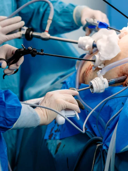 La mano de un cirujano que sostiene un instrumento médico durante la cirugía. — Foto de Stock