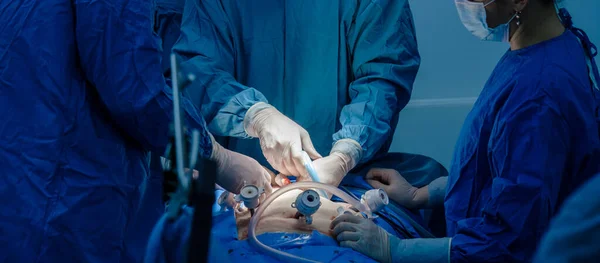 A mão de um cirurgião segurando um instrumento médico durante a cirurgia. — Fotografia de Stock