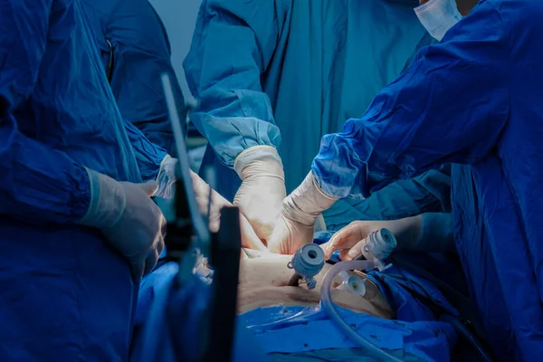 De hand van een chirurg die een medisch instrument vasthoudt tijdens een operatie. — Stockfoto