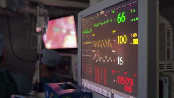 Le apparecchiature mediche ad alta tecnologia monitorano gli indicatori dello stato del corpo. — Video Stock