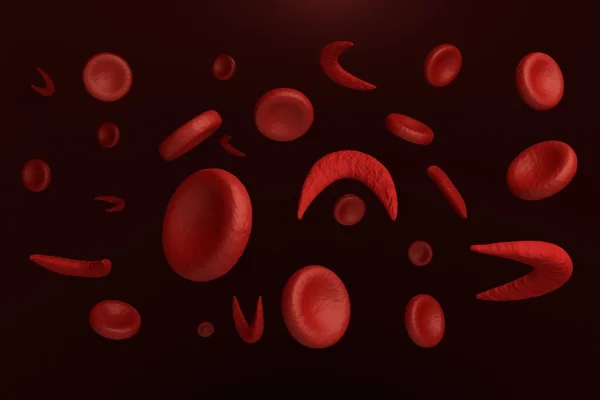 Falciforme e glóbulos vermelhos normais — Fotografia de Stock