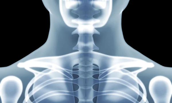İnsan iskelet göğüs x-ray görüntü