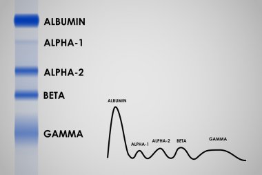 Kan serum protein elektroforez electrophoretogram