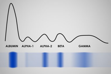 Kan serum protein elektroforez electrophoretogram