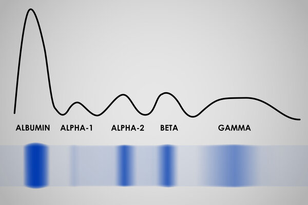 Blood serum protein electrophoresis electrophoretogram