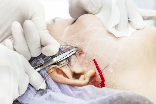 Operazione DOP Suture — Foto Stock