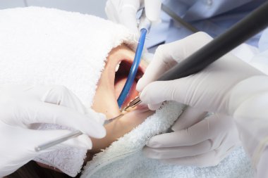 Kadın diş ve diş hekimi ölçekleme