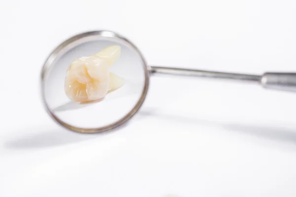 Espejo Dentista Con Reflejo Dientes Fondo Blanco —  Fotos de Stock