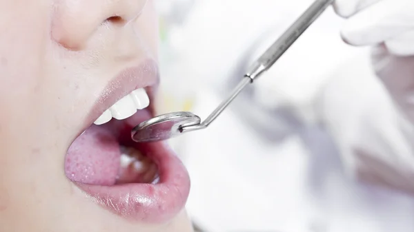 Kvinnan tänder och en tandläkare — Stockfoto