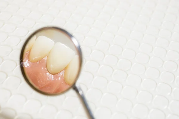 치과 치아의 반사와 거울 — 스톡 사진