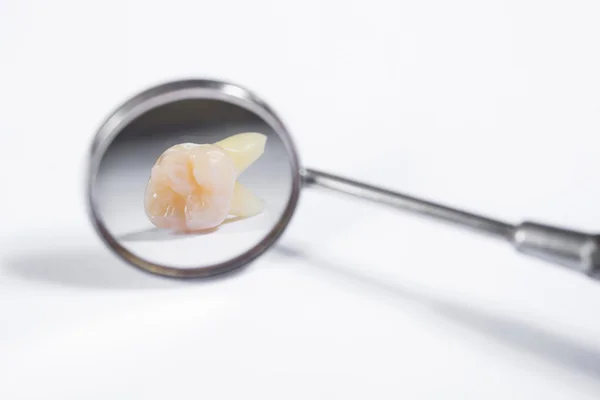 Yansıma diş dişçi aynası — Stok fotoğraf