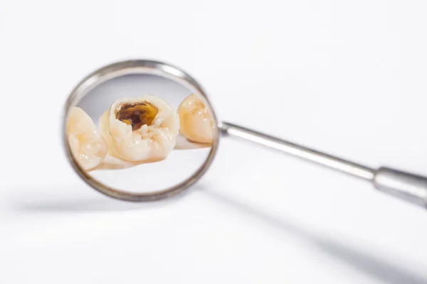 Diş implantları ve protez önleme, diş hekimi