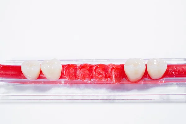 Protesi dentarie dettagliate isolate — Foto Stock