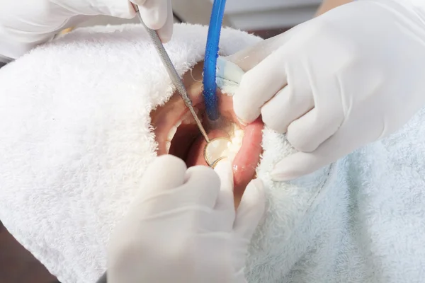 Dentes de mulher e um dentista — Fotografia de Stock