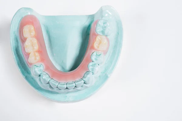 Conjunto de dentadura isolado — Fotografia de Stock