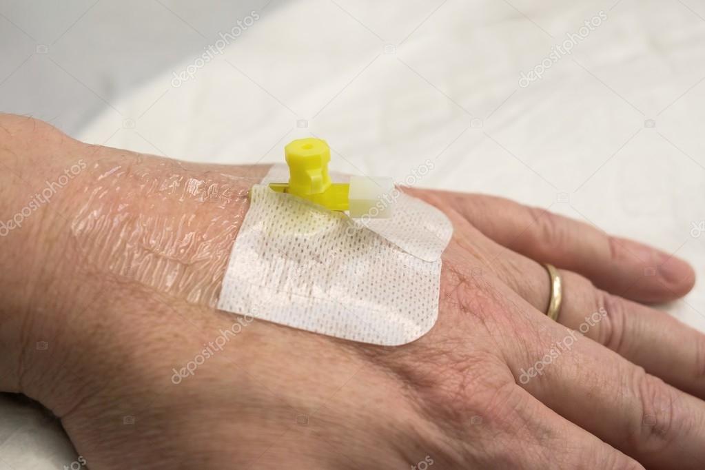 Infusion Katheter in der hand — Stockfoto © JGade 70015669