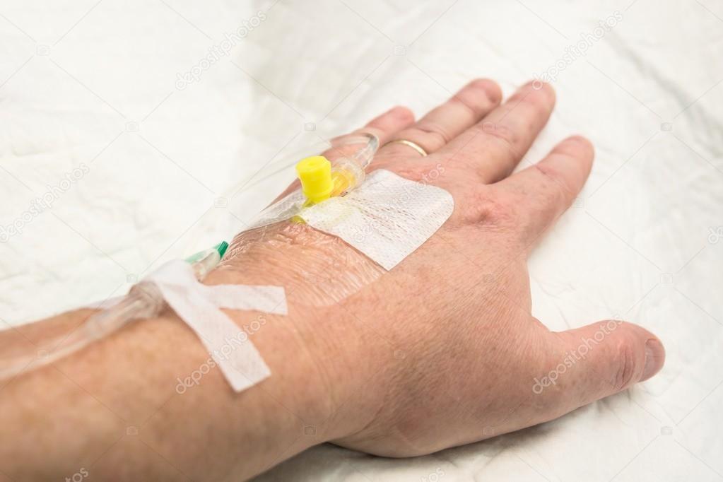 Infusion given into hand