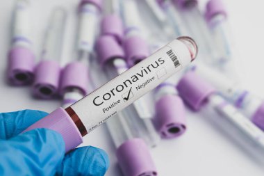 Coronavirus (COVID-19) için yapılan kan testlerinde koronavirüs testi pozitif çıktı. Covid-19 konsepti.