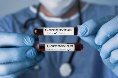 Pozitif ve negatif Coronavirus 'lu test tüpleri tutan doktor kan örneklerini test ediyor. Covid 19 kavramı ve arkaplanı.