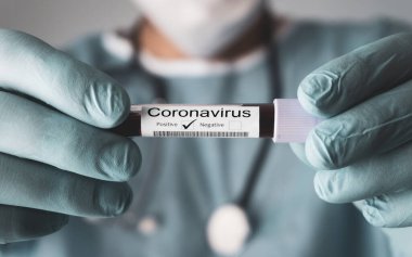 Coronavirus testi pozitif sonuç verdi, Covid-19. Doktor kan testinin sonucunu gösteriyor. 2019 Roman Coronavirus konsepti.