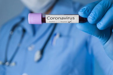 Doktor koronavirüs negatif kan testi örneği gösteriyor. Covid-19 konsepti.