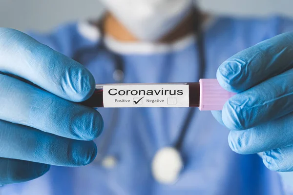 Θετικό Αποτέλεσμα Της Δοκιμής Coronavirus Covid Γιατρός Δείχνει Αποτέλεσμα Της — Φωτογραφία Αρχείου