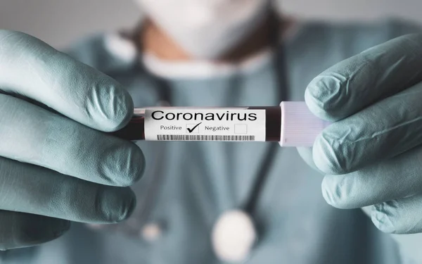 Θετικό Αποτέλεσμα Της Δοκιμής Coronavirus Covid Γιατρός Δείχνει Αποτέλεσμα Της — Φωτογραφία Αρχείου