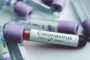 Coronavirus (COVID-19) için yapılan kan testlerinde koronavirüs testi pozitif çıktı. Covid-19 konsepti.