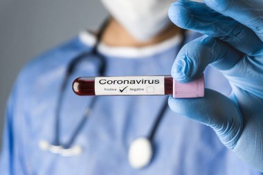 Doktor, stetoskop, koruyucu giysi ve tıbbi maske ile koronavirüs pozitif kan testi örneği gösteriyor..