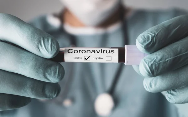 Δείγματα Αιματολογικών Εξετάσεων Για Την Παρουσία Του Coronavirus Covid Σωλήνα — Φωτογραφία Αρχείου