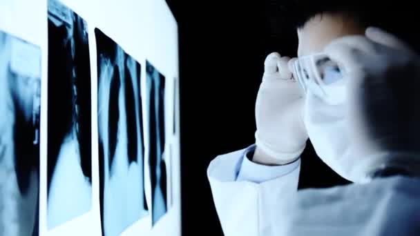 Close Up Young Surgeon Looking at X ray Scans — Stock Video