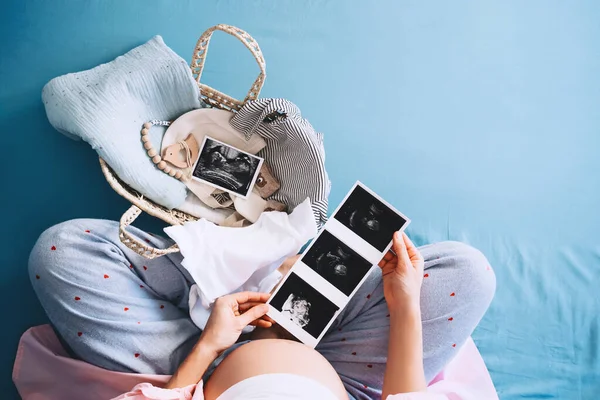 孕妇在看超声波图像 孕妇在怀孕期间等待和准备分娩 妈妈带着一篮柳条筐的东西给新生儿吃 — 图库照片
