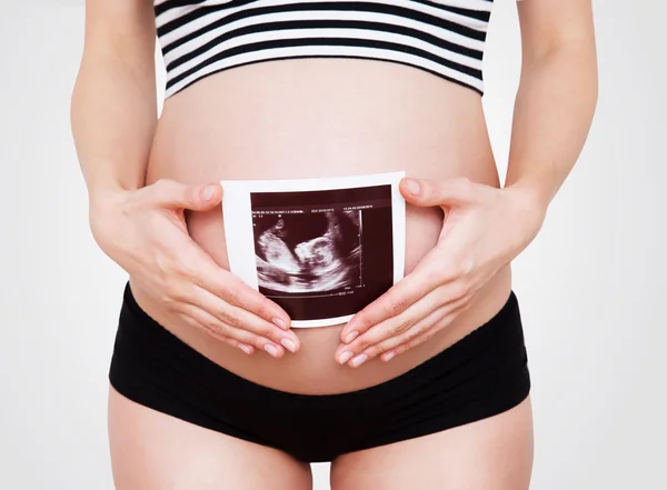 Mulher grávida segurando imagem de ultra-som — Fotografia de Stock