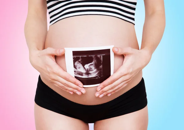 Mujer embarazada sosteniendo imagen de ultrasonido —  Fotos de Stock