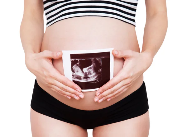 Mujer embarazada sosteniendo imagen de ultrasonido — Foto de Stock