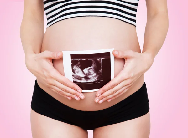 Беременная женщина с ультразвуковым изображением — стоковое фото