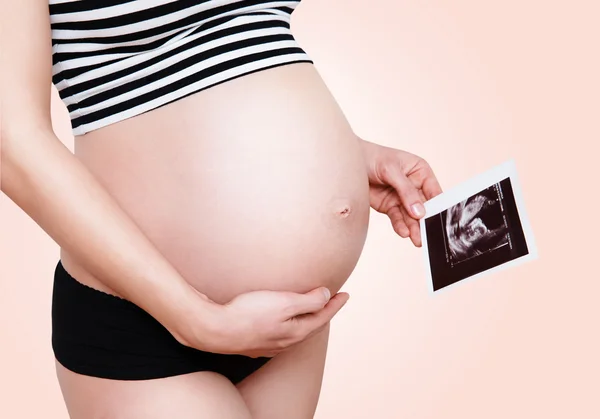 Mulher grávida segurando imagem de ultra-som — Fotografia de Stock