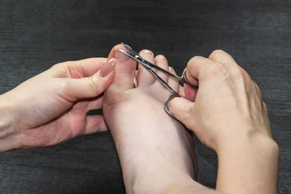 A woman cuts nails her son on the leg. Women\'s hands hold nail scissors and cut nail.