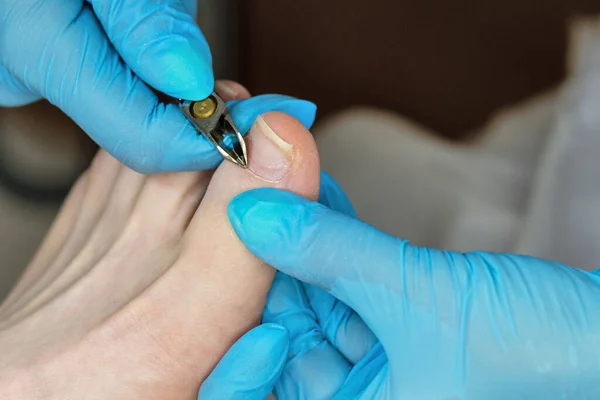 Master chiropody removes cuticle