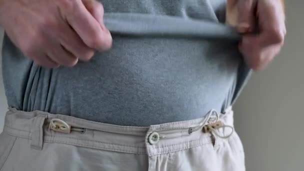 Hombre Levanta Camisa Para Ver Mostrar Moretones Estómago Por Inyecciones — Vídeos de Stock