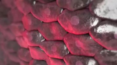 Atheroskleroz Kalp krizine neden olur